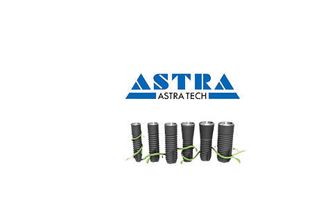 Имплант <span>Astra Tech</span> под ключ + цельноциркониевая коронка Multilayer