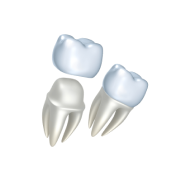 Металлокерамические коронки