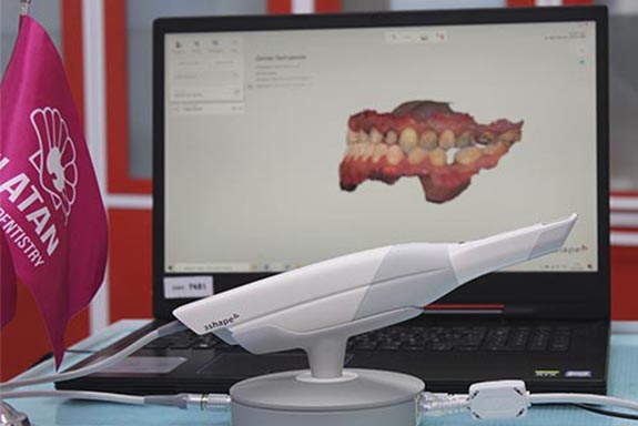 Сканер 3shape — цифровое сканирование зубов