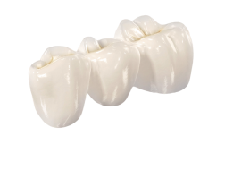 Циркониевые коронки