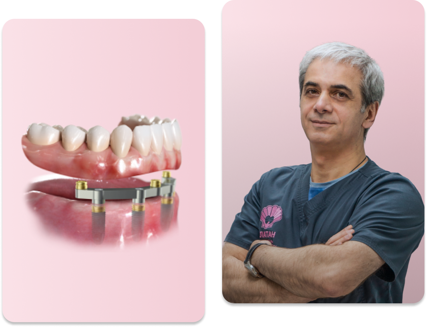 Имплантация зубов All-on-4