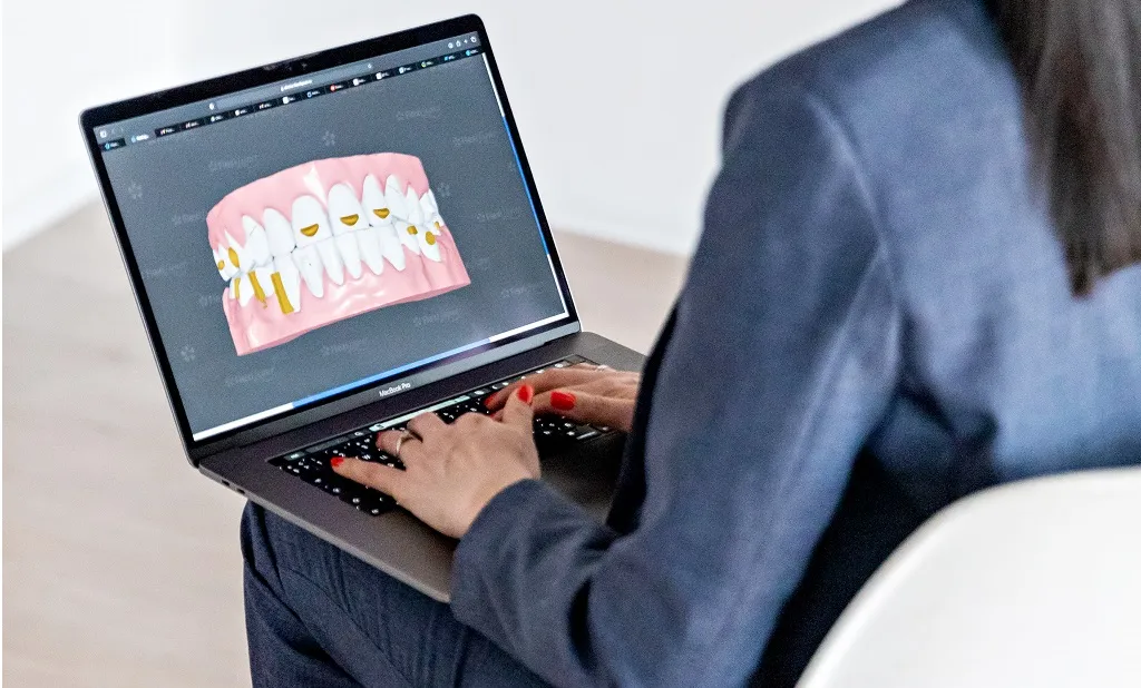 Этапы лечения на элайнерах FlexiLigner