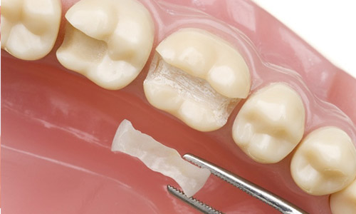 эстетическая стоматология