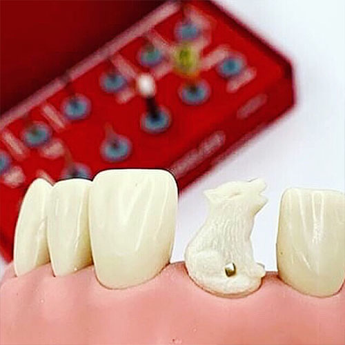 съемное протезирование зубов